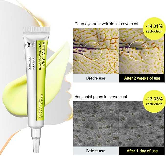 Ratinal shot tightening booster